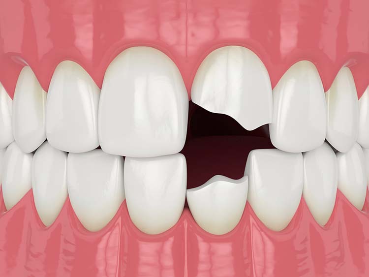 broken teeth book online monmouth freehold new jersey